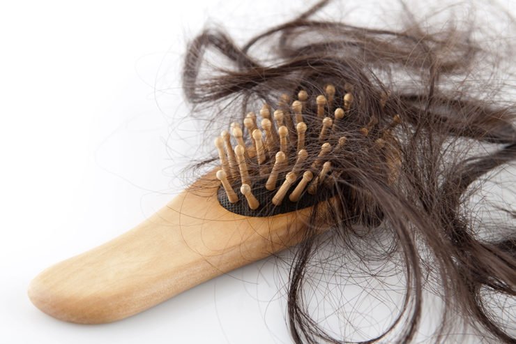Female Hair Loss Treatment | Skin and Sculpt | Chandigarh | Panchkula | Mohali | India | North India